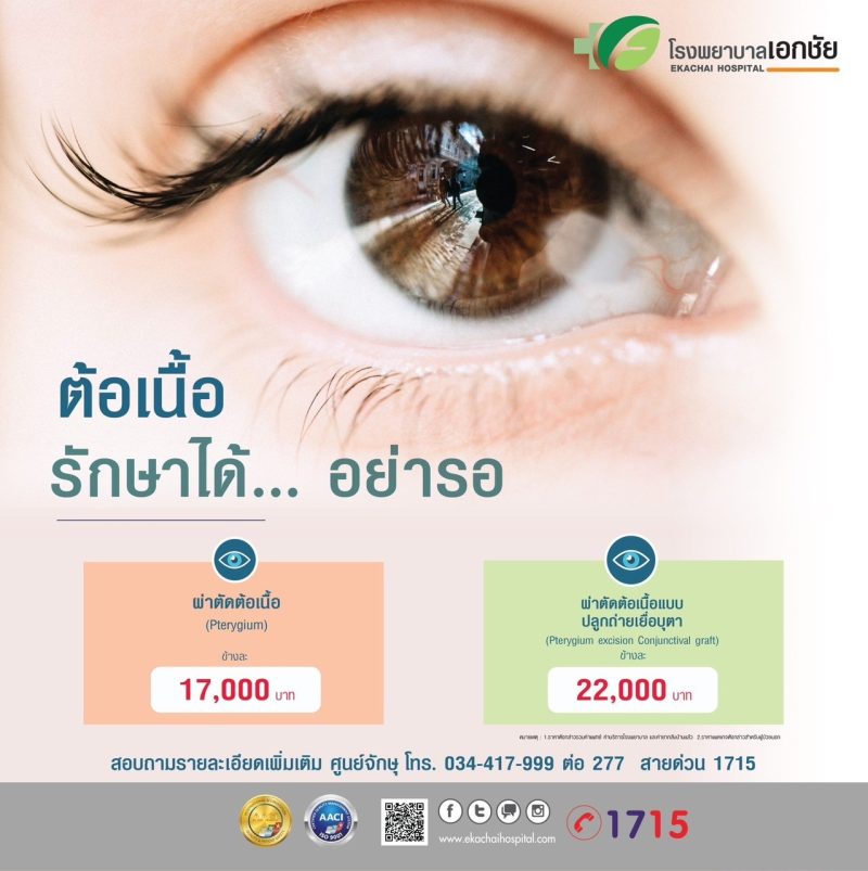 ผ่าตัดต้อเนื้อ | โรงพยาบาลเอกชัย